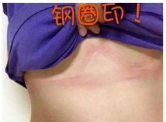 穿上内衣后，总觉得胸闷，呼吸困难是怎么回事