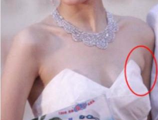 副乳到底是什么样的，要怎样穿文胸才不会长副乳