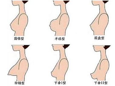 圆盘型胸部最适合穿什么内衣