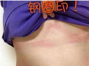 钢圈印在什么位置是正常的