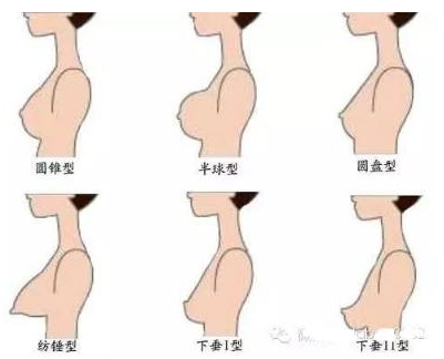 怎么挑选适合自己的内衣，女生一定要知道的事